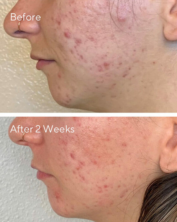Murad Daily Clarifying Peel
