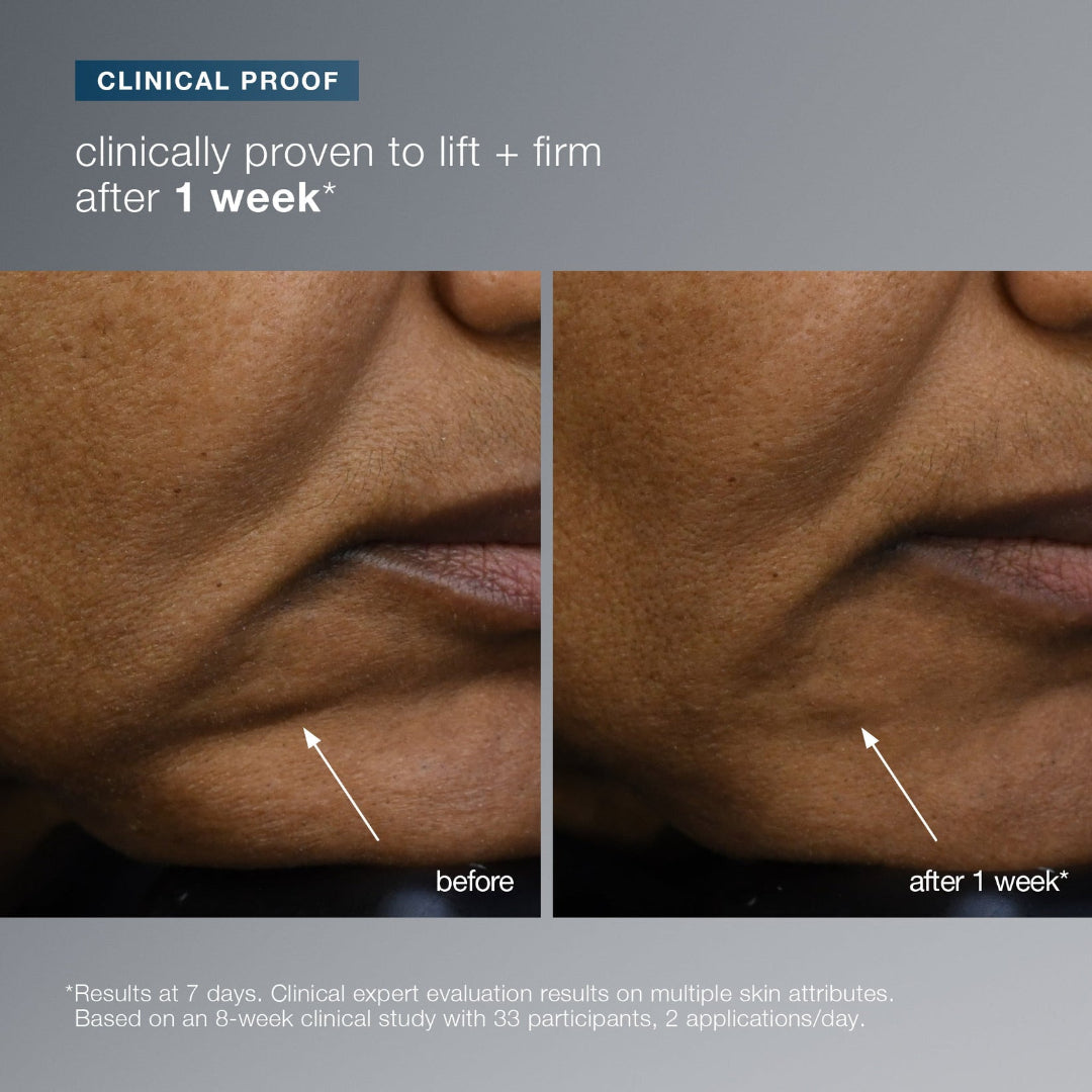 Before and after comparison of skin lifting and firming treatment with clinical proof text.