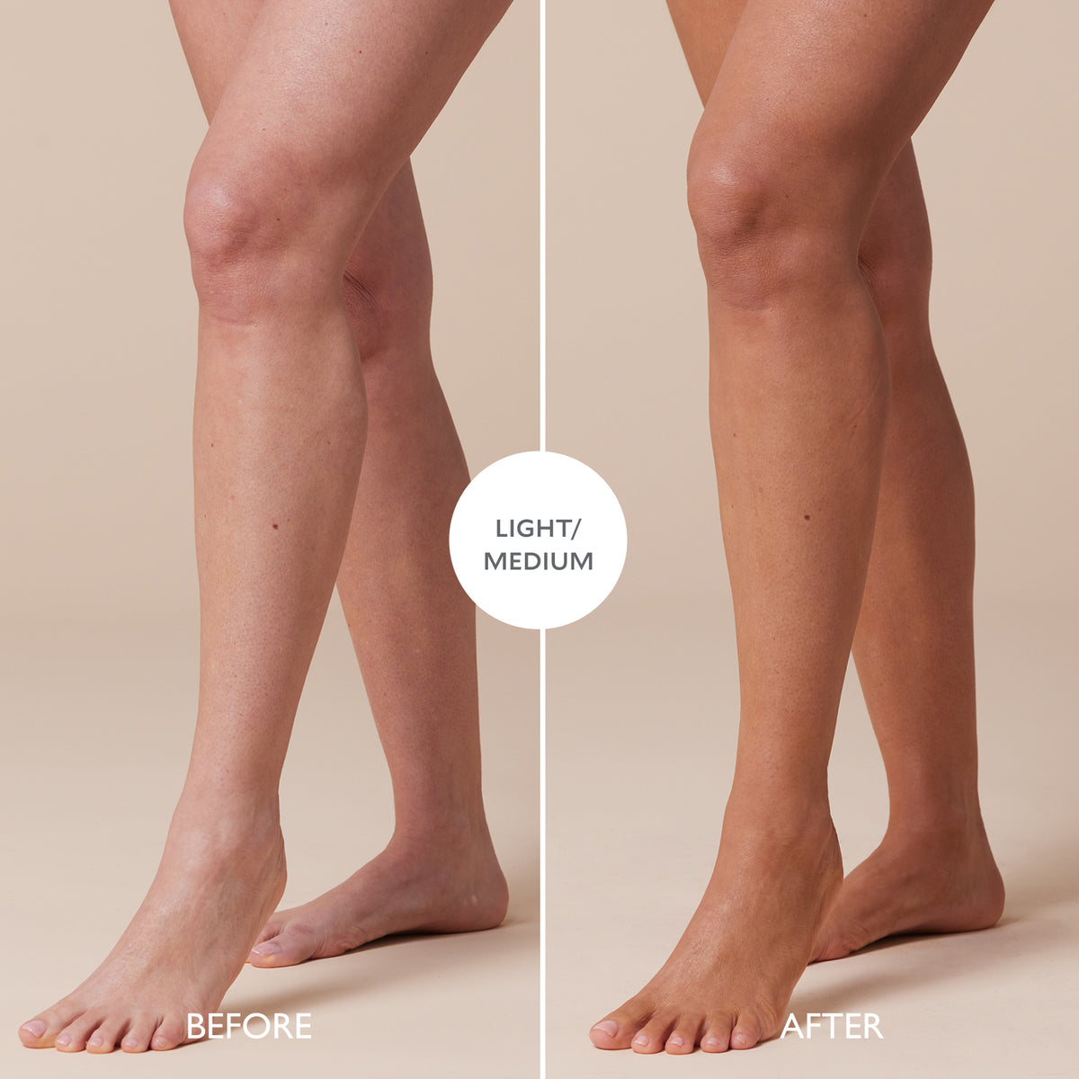 Before and after comparison of legs with a light/medium treatment on a beige background