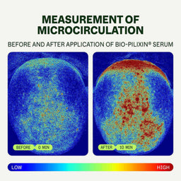 Before and after measurement of microcirculation with Bio-Pilixin Serum on a blue background.