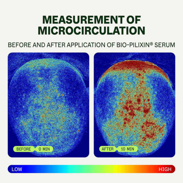 Before and after measurement of microcirculation with Bio-Pilixin Serum on a blue background.