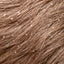 Dandruff