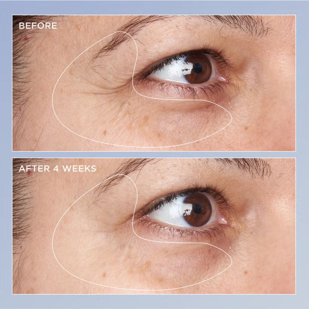 Perricone MD High Potency Triple Retinol Renewal Eye Serum 15ml