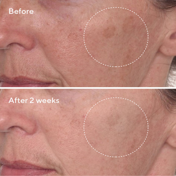 Murad Rapid Dark Spot Correcting Serum