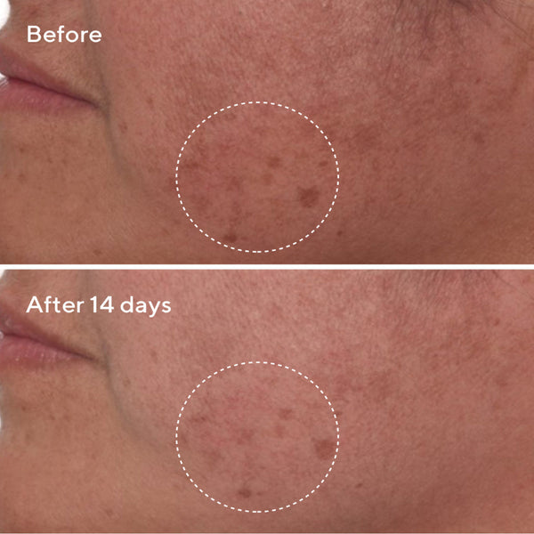 Murad Rapid Dark Spot Correcting Serum