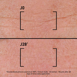 FILORGA TIME-FILLER INTENSIVE 5XP - Correcting Serum For All Types of Wrinkles