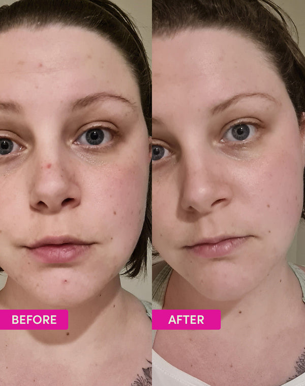 Before and after using Sand & Sky Australian Glow Berries Intense Glow Moisturiser