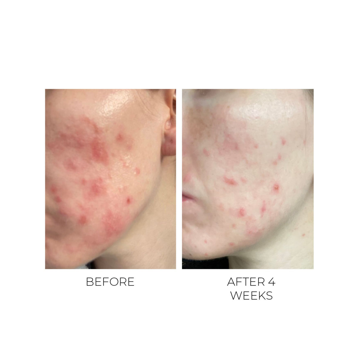 OSKIA Violet Water Hydra-Gel