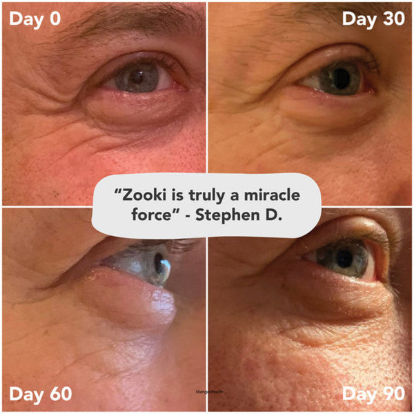 A four-panel before-and-after comparison grid showing a close-up of a person's eye and surrounding skin at Day 0, Day 30, Day 60, and Day 90, with a speech bubble quote in the center reading, 