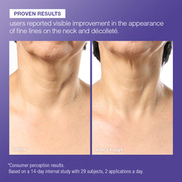 Dermalogica Phyto Nature E²