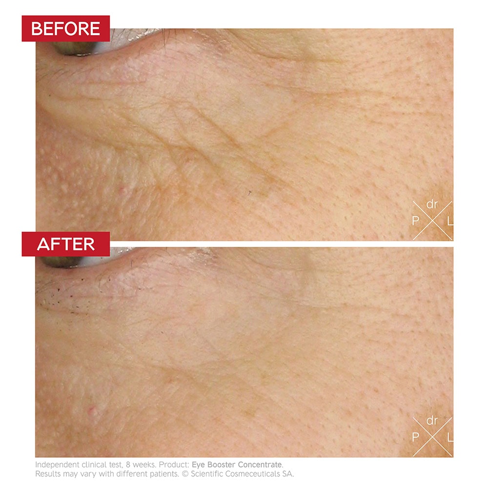 Dr LEVY Switzerland Eye Booster Concentrate | Face the Future