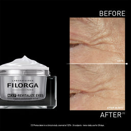 Filorga NCEF Revitalize Eyes cream with 'Before' and 'After' skin texture comparison on a black background