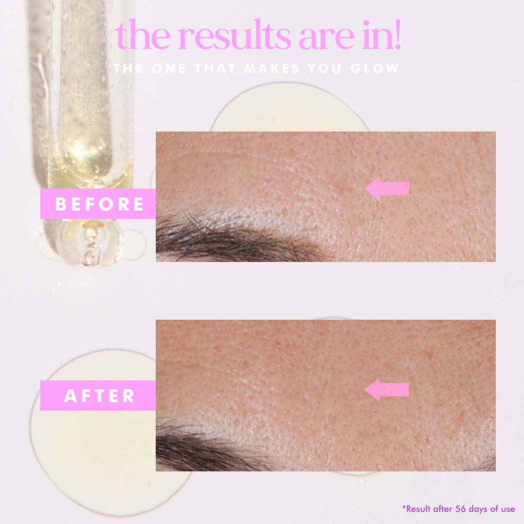 before and after