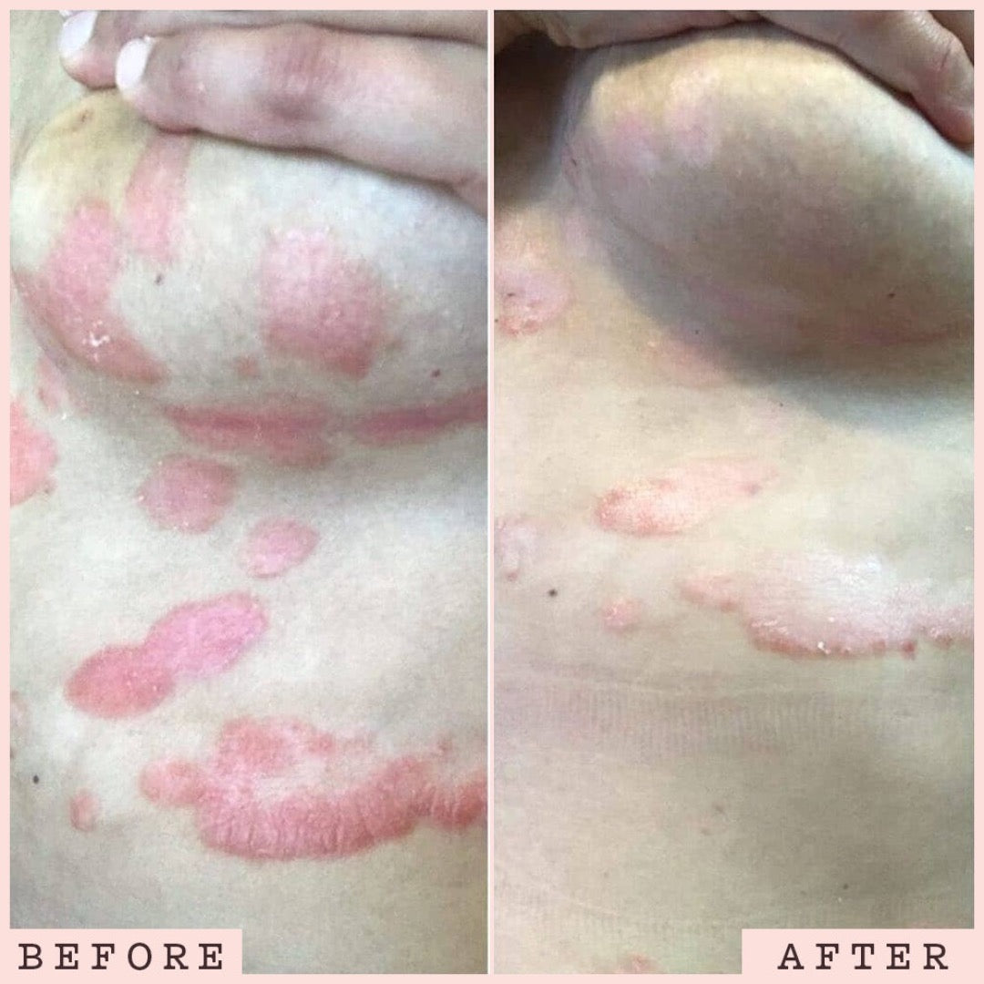 before and after
