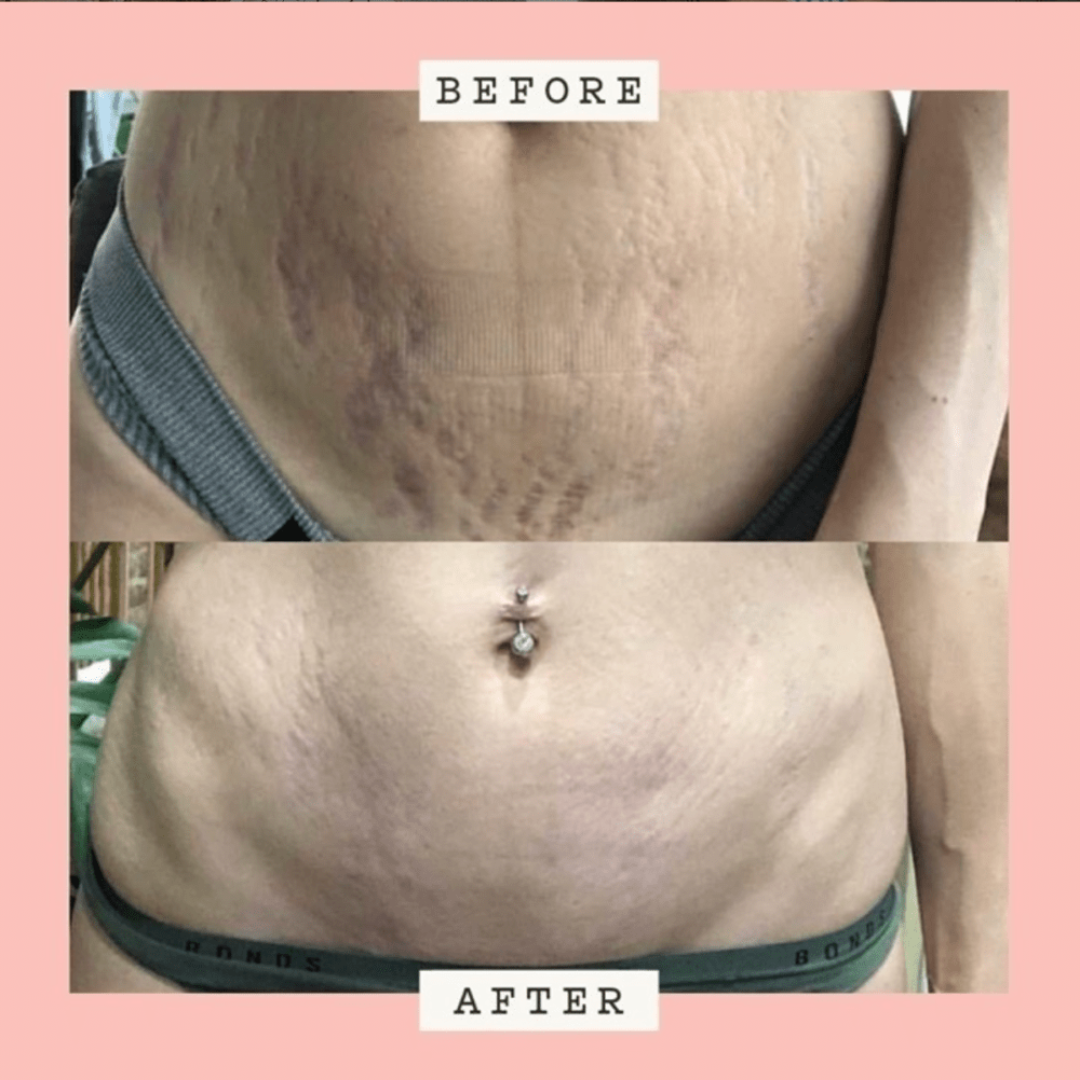 Frank Body Original Coffee Scrub 100g