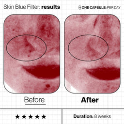 Before and after of Advanced Nutrition Programme Skin Blue Filter