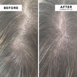 WE ARE PARADOXX Growth Advanced Scalp Serum 50ml before and after