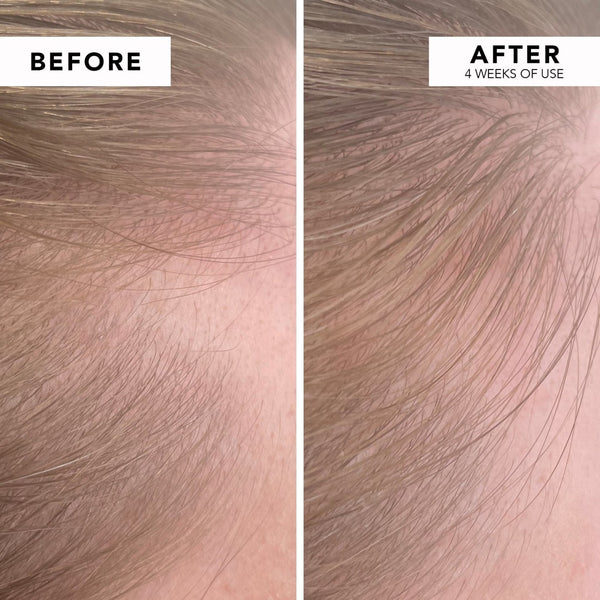 WE ARE PARADOXX Growth Advanced Scalp Serum 50ml before and after