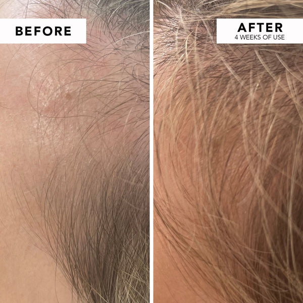 WE ARE PARADOXX Growth Advanced Scalp Serum 50ml before and after