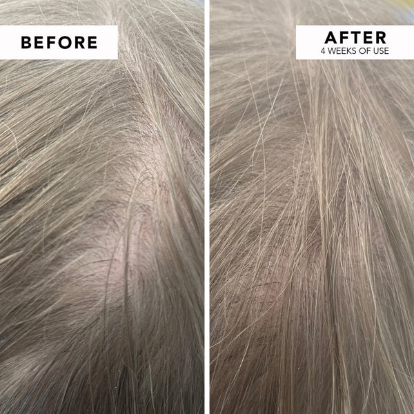 WE ARE PARADOXX Growth Advanced Scalp Serum 50ml before and after